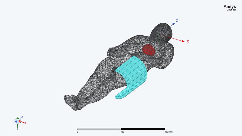Blog_TechArtikel_Implantat_MRT_Feldverzerrer